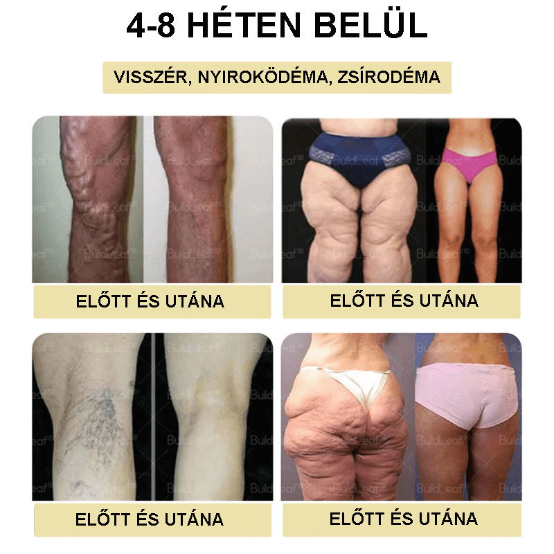 Clinica Cleveland și Mayo | Picături Tirzepatide GIP/GLP-1 cu acțiune dublă pentru slăbit și îmbunătățirea sănătății (Arzător de grăsimi de calitate alimentară – Dezvoltat de Societatea pentru Obezitate)