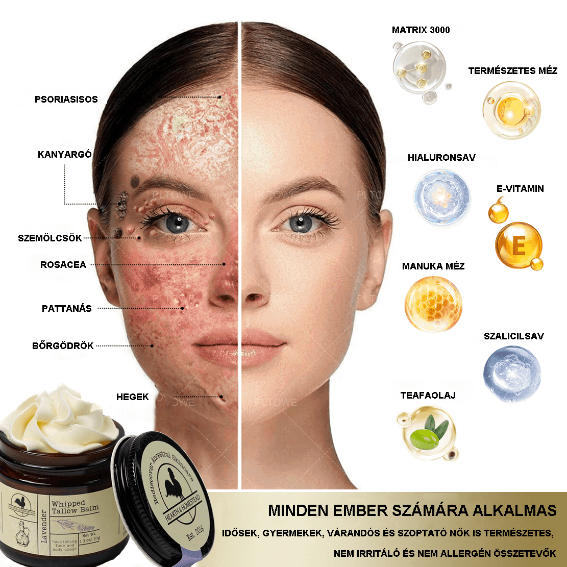 🔥Kézzel készített faggyúbalzsam (hozzáadott gyógynövényekkel) Bio testvaj hozzáadott olívaolajjal, ekcéma, rosacea kezelésére, babáknak