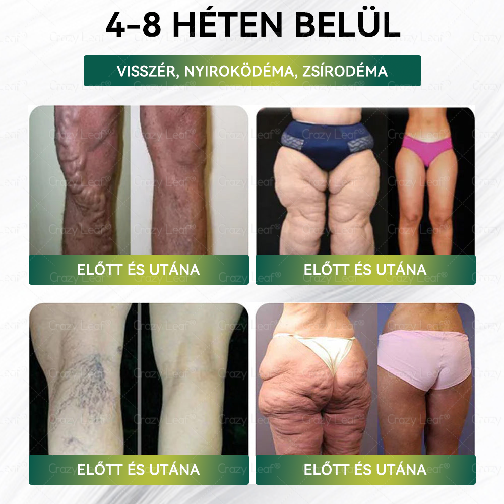 Mayo Klinika által ajánlott | ☘️CrazyLeaf® Meglutide GLP-1 Aktiváló Oralis Oldat – Tartalmaz moringát, NAD+-t és yerba matét, természetes támogatás fogyáshoz, öregedésgátláshoz és cukoranyagcseréhez